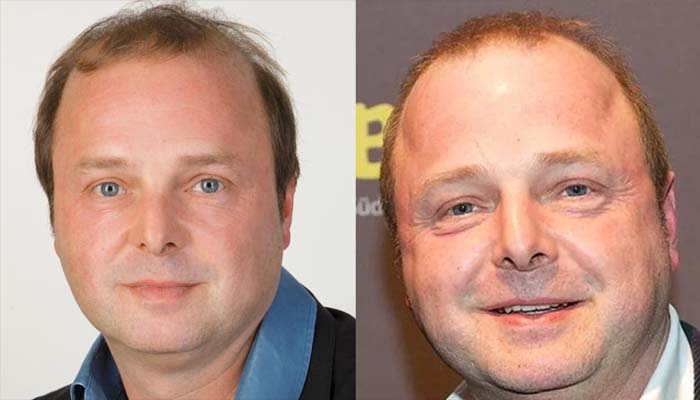 Wolfgang Feindt Todesursache: Aktuelle Infos Wolfgang Feindt Todesursache